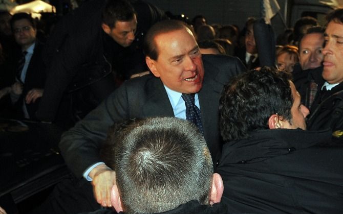 Berlusconi na de aanval. - Foto EPA