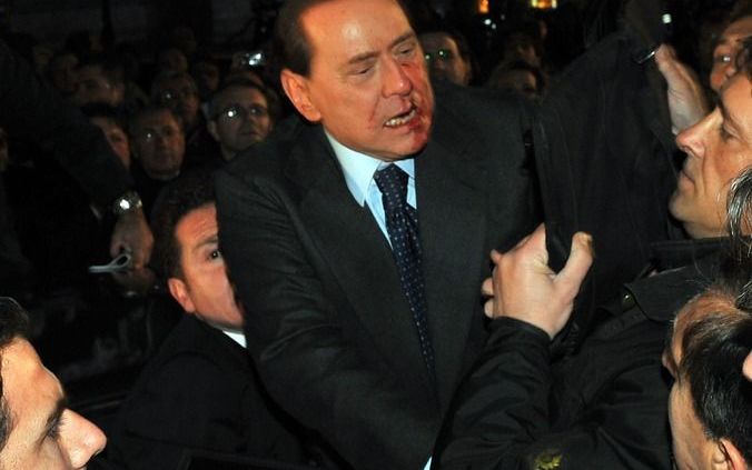 Silvio Berlusconi na de aanval van een verwarde landgenoot. Foto EPA