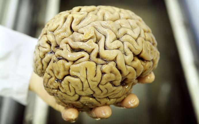 De Nijmeegse neuroloog Frank Erik de Leeuw heeft mogelijk een voorstadium van de ziekte van Alzheimer ontdekt. Hij vond dat oudere mensen met lichte geheugenklachten een gekrompen hippocampus hebben. Foto ANP