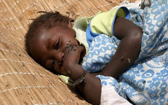 SENEGAL - Een Sengalees meisje dat aan cholera leidt. Foto EPA