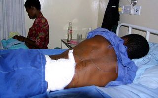 Slachtoffers van politiek geweld in een ziekenhuis in Marondera, 70 kilometer ten oosten van Harare. Foto EPA