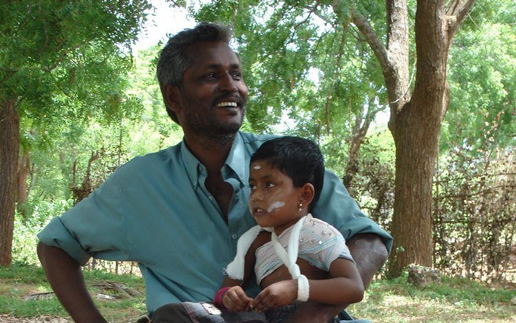 Een Tamil met geamputeerd been in het opvangcentrum Varod, bij de stad Vavuniya. Hij is een van de vele slachtoffers van de zware veldslag tussen Tijgers en het regeringsleger in mei vorig jaar.  Foto RD