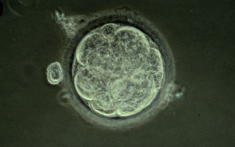 Een vroeg embryo wordt bij ivf in de baarmoeder geplaatst. Slechts een deel van die pogingen resulteert in een zwangerschap. beeld M. Johnson