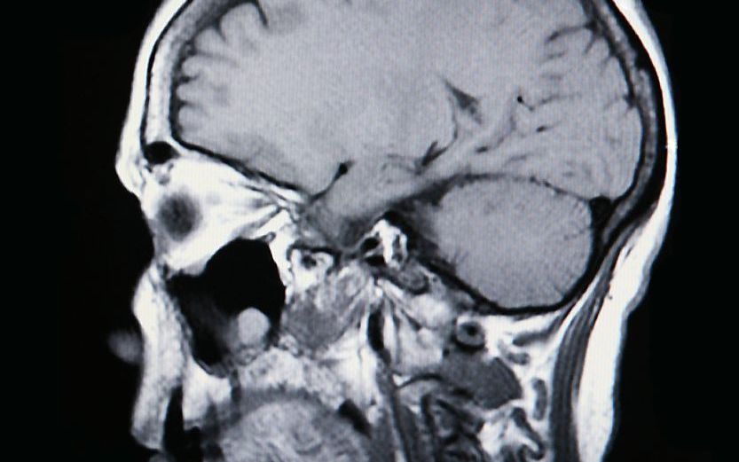 Op basis van onderzoek met een MRI-scanner meenden wetenschappers een zogenaamd ”Godgebied” in het brein gevonden te hebben. Foto Fotolia