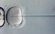 Injectie van een zaadcel (zichtbaar in de naald) in een eicel, uitgevoerd op de IVF-afdeling van het academisch ziekenhuis Maastricht (azM). beeld ANP