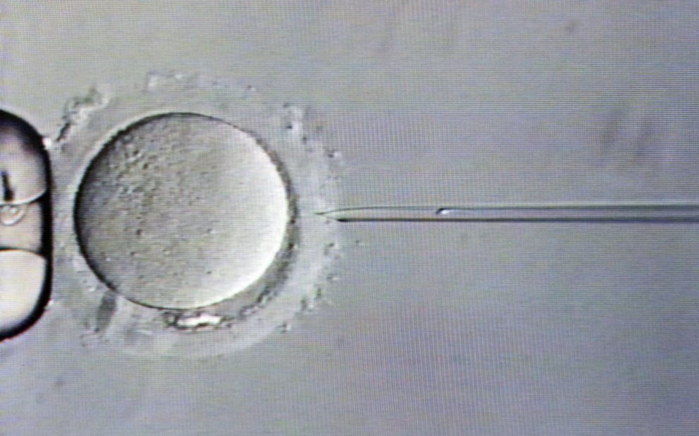 Injectie van een zaadcel (rechts zichtbaar in de naald) in een eicel, uitgevoerd op de IVF-afdeling van het academisch ziekenhuis Maastricht (azM). Foto ANP